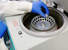 Centrifuge Degassing